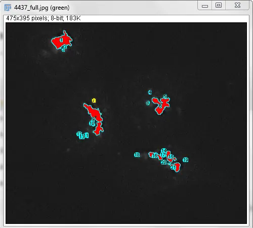 Golgi Thresholded - In this example I had too many objects